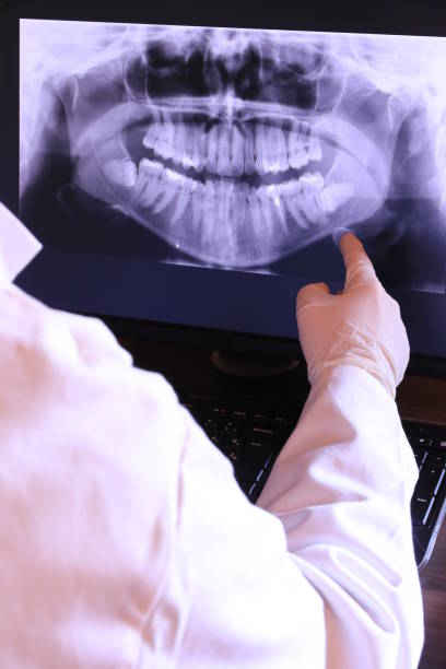 Best Emergency Treatment for Dental Infections or Abscesses in Bonanza, GA