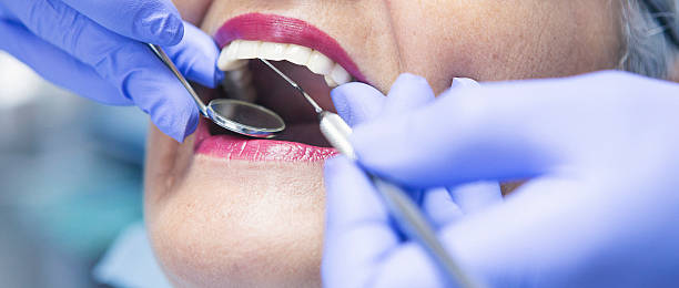 Best Emergency Dental Care for Broken or Chipped Teeth in Bonanza, GA